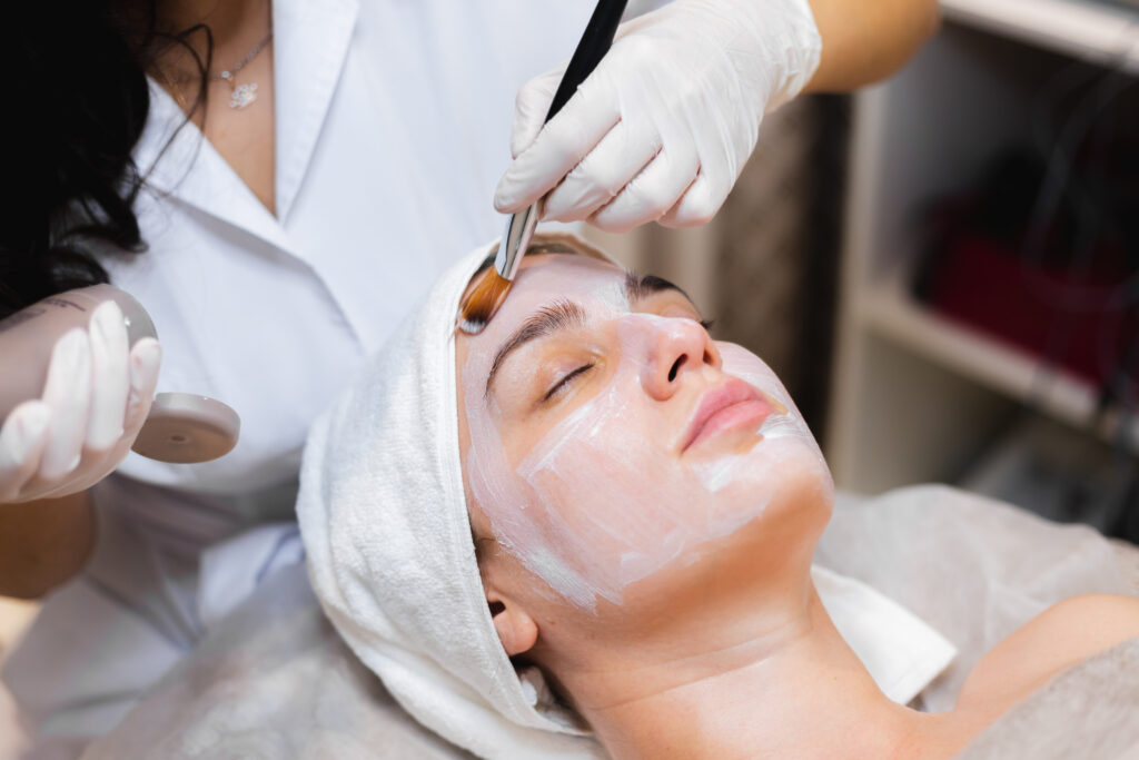 Chemical peel