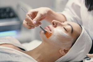 Chemical peel